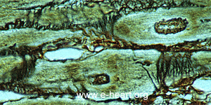 Myocyte reticulum
